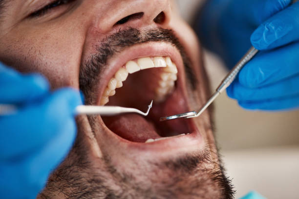 Best Emergency Care for Gum Disease in Topeka, IN