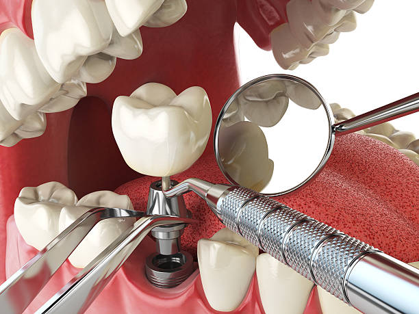 Best Weekend Emergency Dental Services in Topeka, IN